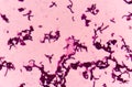 Bacteria cells with Gram stain