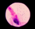 Bacteria cells on Gram stain