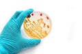 Bacteria colonies Royalty Free Stock Photo