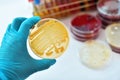 Bacteria colonies Royalty Free Stock Photo