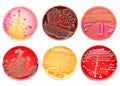 Bacteria colonies Royalty Free Stock Photo