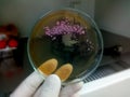 Bacteria colony in culture media plate. Stool culture, E.coli