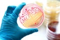 Bacteria culture Royalty Free Stock Photo