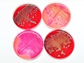 Bacteria culture Royalty Free Stock Photo