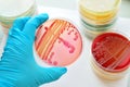 Bacteria culture Royalty Free Stock Photo
