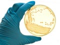 Bacteria culture