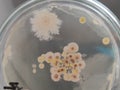 Bacteria and fungi on sabouraud dextrose agar medium Royalty Free Stock Photo