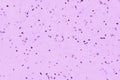 Bacteria or germs microorganism cells under microscope in the color chemical pink fluid