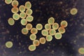 Bacteria methicillin-resistant Staphylococcus aureus MRSA