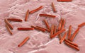 Bacteria Mycobacterium tuberculosis Royalty Free Stock Photo