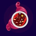 Bacteria in stomach - illustration