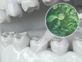 Bacteria and viruses around tooth 2 of 2 - 3D Rendering