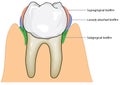 Bacterial biofilm formation on tooth