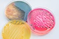 Bacterial colonies culture on Differential and Selective media Royalty Free Stock Photo