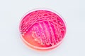 Bacterial colonies culture on Differential and Selective media Royalty Free Stock Photo