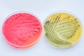 Bacterial colonies culture on Differential and Selective media Royalty Free Stock Photo