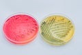 Bacterial colonies culture on Differential and Selective media Royalty Free Stock Photo