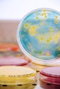 Bacterial colonies culture on Differential and Selective media Royalty Free Stock Photo