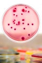 Bacterial colonies culture Royalty Free Stock Photo