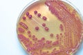 Bacterial colonies culture growth on MacConkey agar (MAC agar).