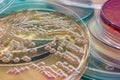 Bacterial colonies culture on MacConkey agar Royalty Free Stock Photo