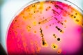 Bacterial colonies culture on selective agar media(SS agar). Royalty Free Stock Photo