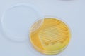 Bacterial colonies culture on selective agar media XLT Agar (Xy Royalty Free Stock Photo