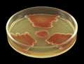 Bacterial colonies like a biohazard sign on agar isolated black