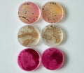 Bacterial colony on selective media Agar Plates in petri dish