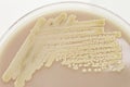 Bacterial culture on agar