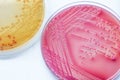 Bacterial culture growth on MacConkey agar media (Escherichai co Royalty Free Stock Photo