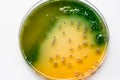 Bacterial culture growth on TCBS Agar. Royalty Free Stock Photo