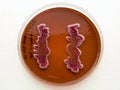 Bacterial growth on differential agar