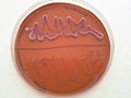 Bacterial growth on differential agar