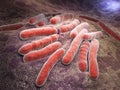 Bacterial infection tuberculosis Royalty Free Stock Photo