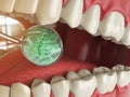 Bacterias and viruses around tooth. Dental hygiene medical concept.