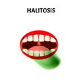 Bad breath. Halitosis. The structure of the teeth and oral cavity. Diseases of the teeth. Infographics. Vector
