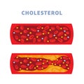 Bad cholesterol level in blood vessel diagram Royalty Free Stock Photo