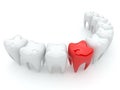 Bad tooth. 3D illustration. Isolated Royalty Free Stock Photo