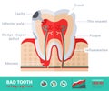 Bad tooth anatomy flat icon concept