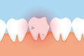 Bad tooth hurting with red danger glow effect vector. A dead tooth vector with a red glow effect. A dead tooth with cavities