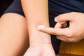 Baking soda being used to relieve itching from insect bites.