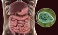 Balantidium coli protozoan in large intestine