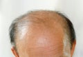 Bald head man Royalty Free Stock Photo