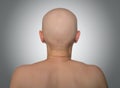 Bald head, rear view