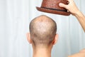 Bald man with a hat