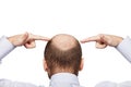 Bald man head Royalty Free Stock Photo