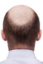 Bald man head Royalty Free Stock Photo