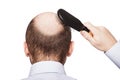 Bald man head Royalty Free Stock Photo