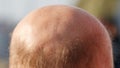 A bald man with a bald spot on his head Royalty Free Stock Photo
